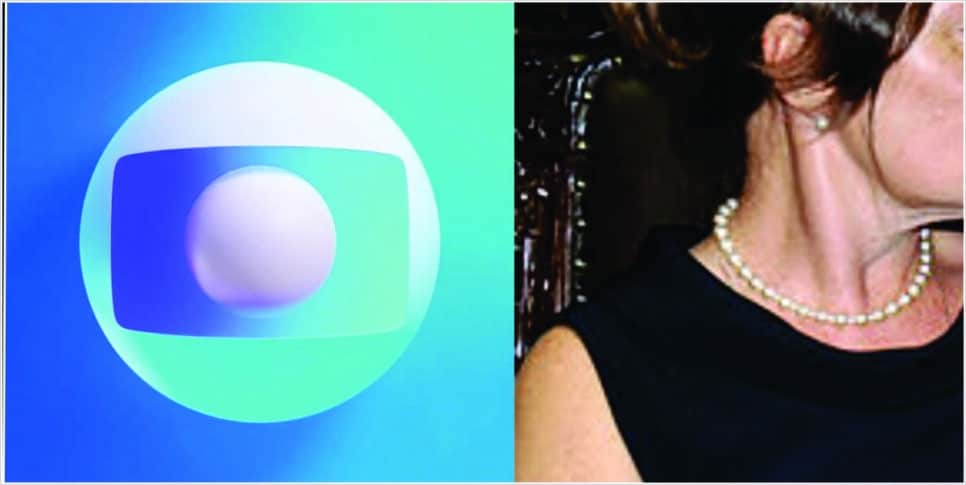 Atriz da Globo bateu o carro quando estava a caminho de seu primeiro trabalho na tv (Foto: reprodução/Montagem/Fatos da TV)