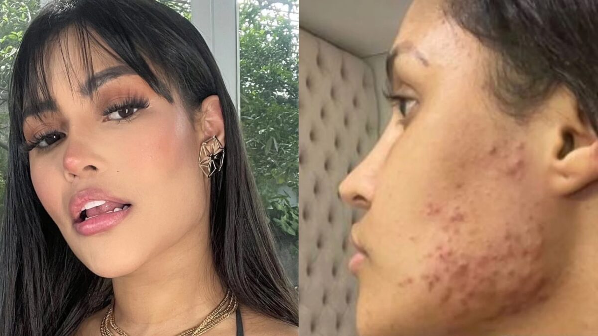 Flay em um paralelo do antes e do depois do chip da beleza 