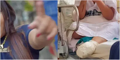 Cantora teve que amputar parte do corpo  (Foto: Reprodução, Montagem, Fatos da TV)