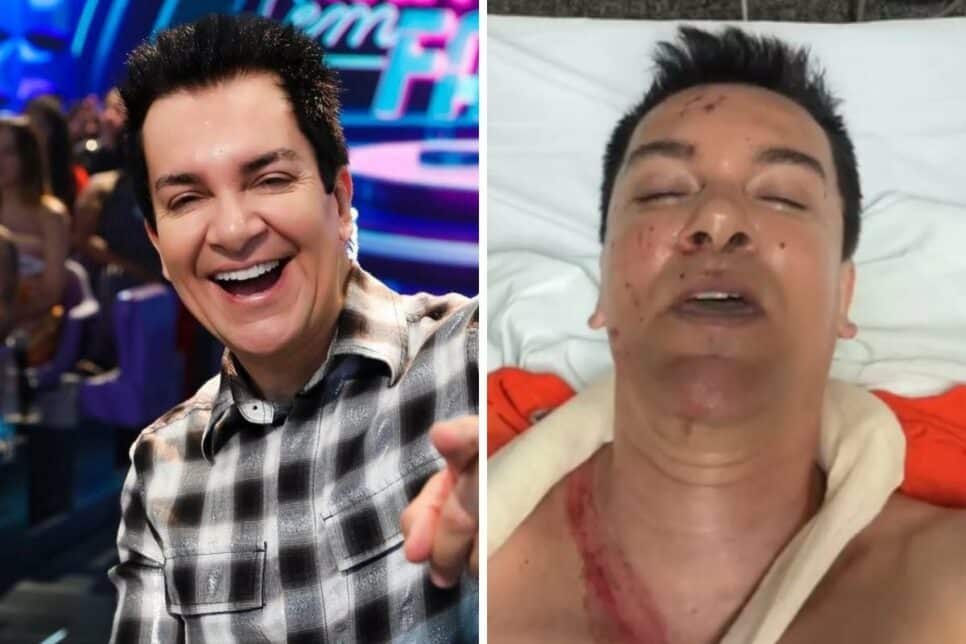 Regis Danese sofreu grave acidente (Foto: Reprodução/ Montagem/Fatos da Tv)