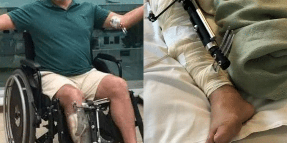 Ator da Globo sofreu grave acidente (Foto: Reprodução, Instagram)