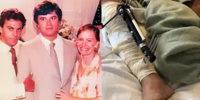 Ator sofreu acidente de moto e precisou passar por cirurgias (Foto: Reprodução, Montagem - Fatos da TV)