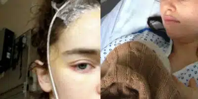 Famosa atriz sofreu dois aneurismas (Foto: Reprodução - Instagram)